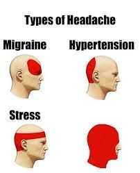 types-of-headaches-meme