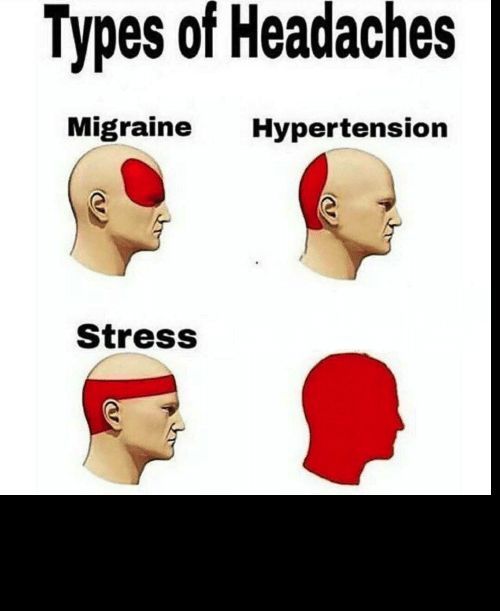 types-of-headaches-meme